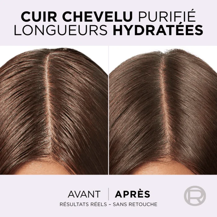 L'Oréal elsève Shampooing Hyaluron pure 400ml Maroc L'Oréal elsève Shampooing Hyaluron pure 400ml